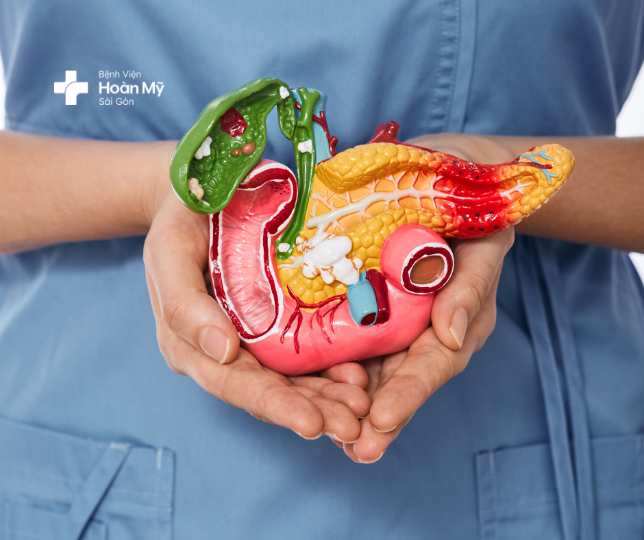 Điều trị thành công bệnh nhân viêm tuỵ cấp với mỡ máu tăng hơn 60 lần | Bệnh viện Hoàn Mỹ Sài Gòn