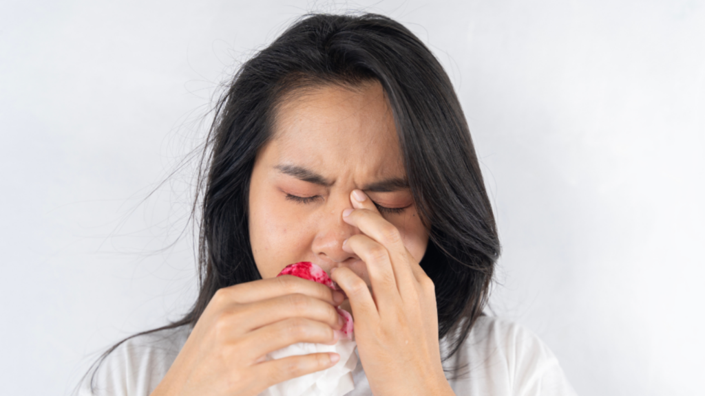 Điều trị chảy máu mũi tái diễn bằng nội soi thắt động mạch bướm khẩu cái