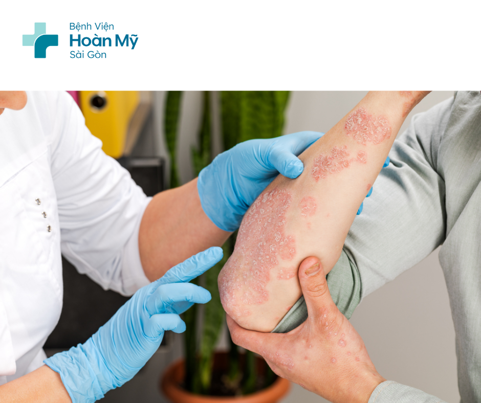 Nếu xuất hiện bất kỳ triệu chứng mẩn đỏ, ngứa ngáy nào trên da, hãy thăm khám ngay ở các cơ sở y tế uy tín
