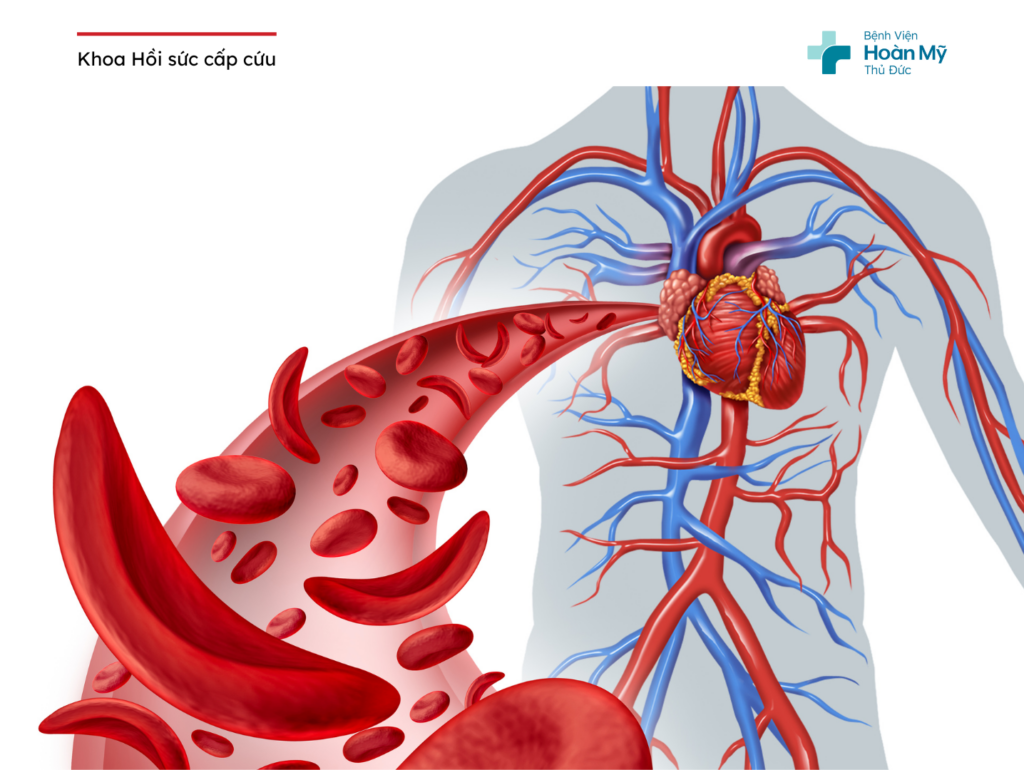 Cấp cứu người bệnh bị chóng mặt thiếu máu nặng do rong kinh kéo dài