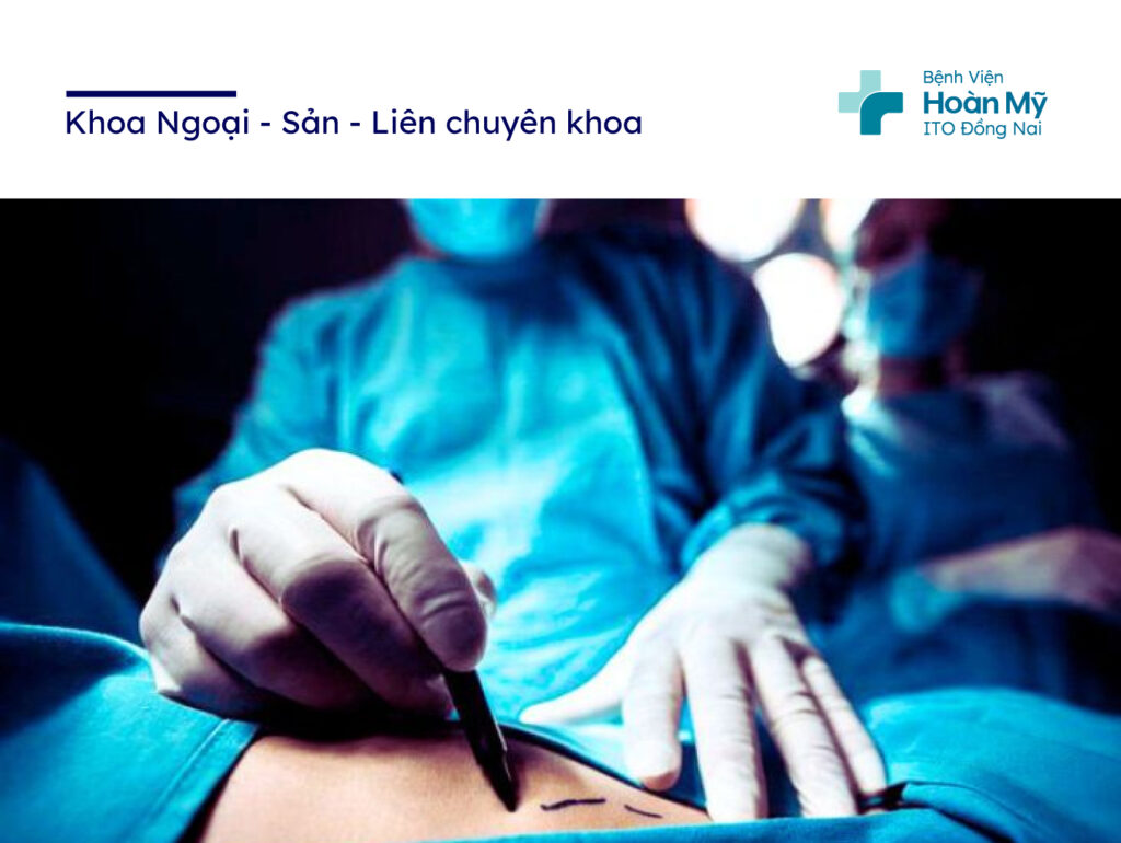 Phương pháp nội soi tuyến giáp