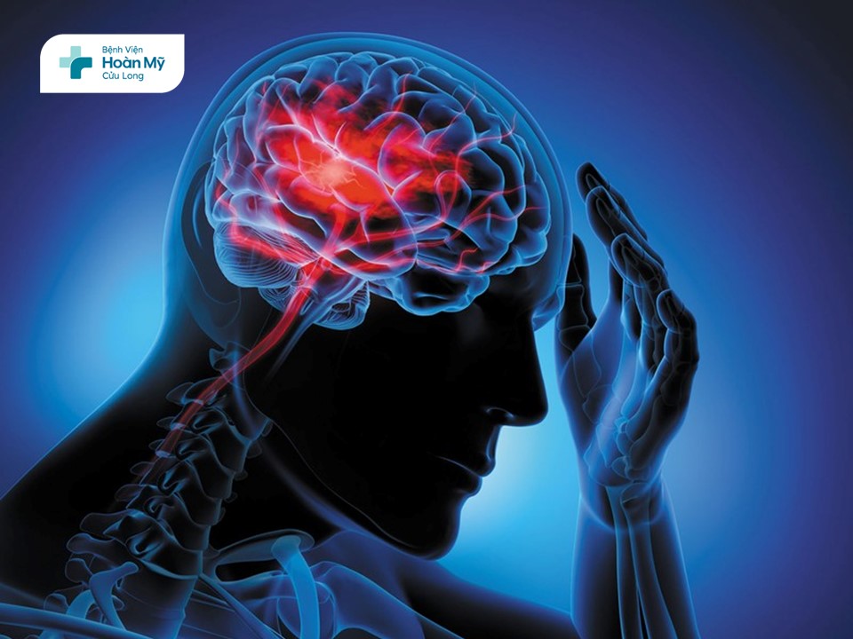 Cơn thiếu máu não cục bộ thoáng qua (TIA)