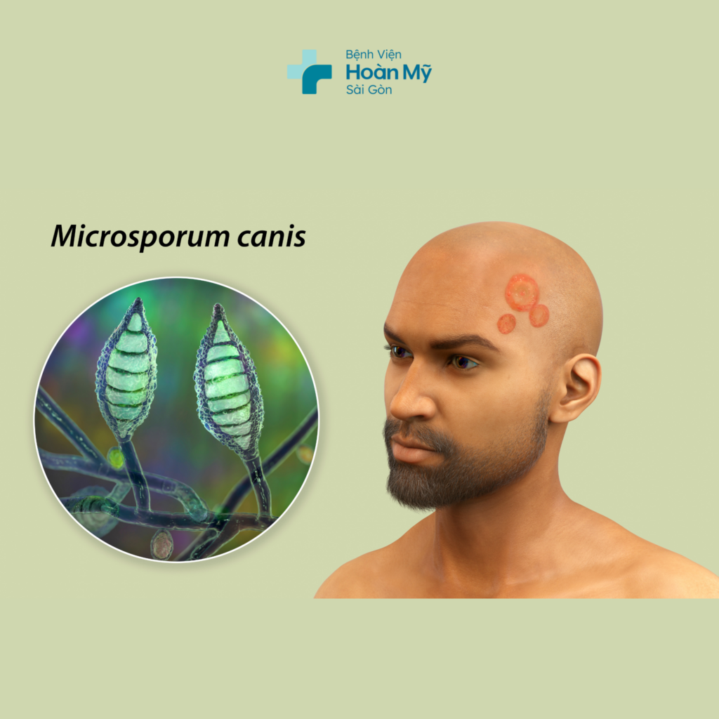 Bệnh lý vi nấm cạn 