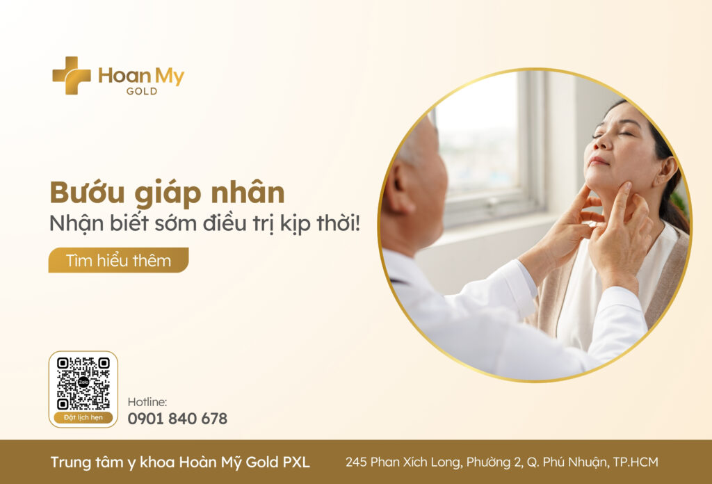 Bướu giáp nhân: Phát hiện sớm, điều trị kịp thời