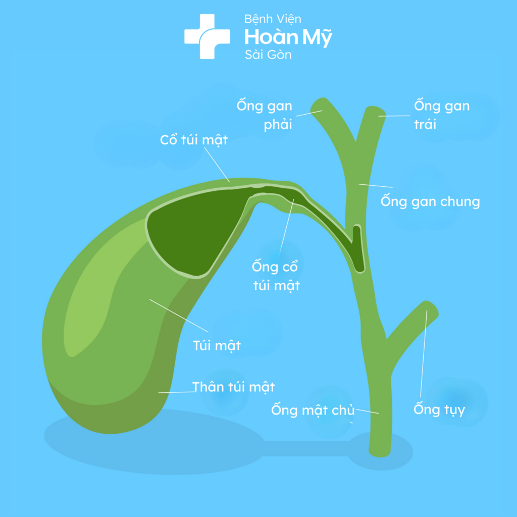 Sỏi túi mật: Những phương pháp điều trị và phòng ngừa tối ưu