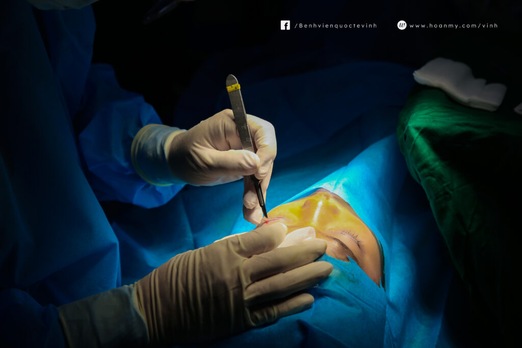 Hành trình chữa lành những nụ cười khiếm khuyết tại Nghệ An 2023