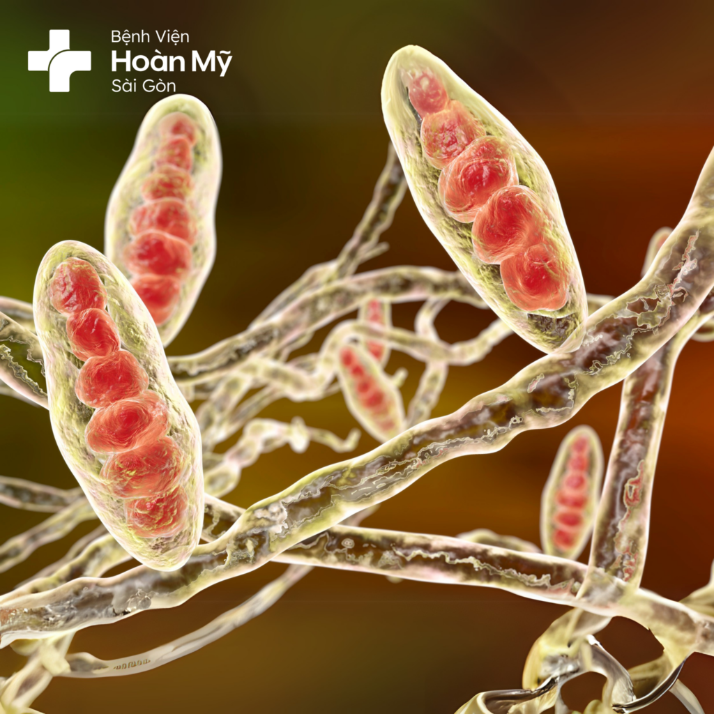 Các bệnh lý vi nấm phổ biến