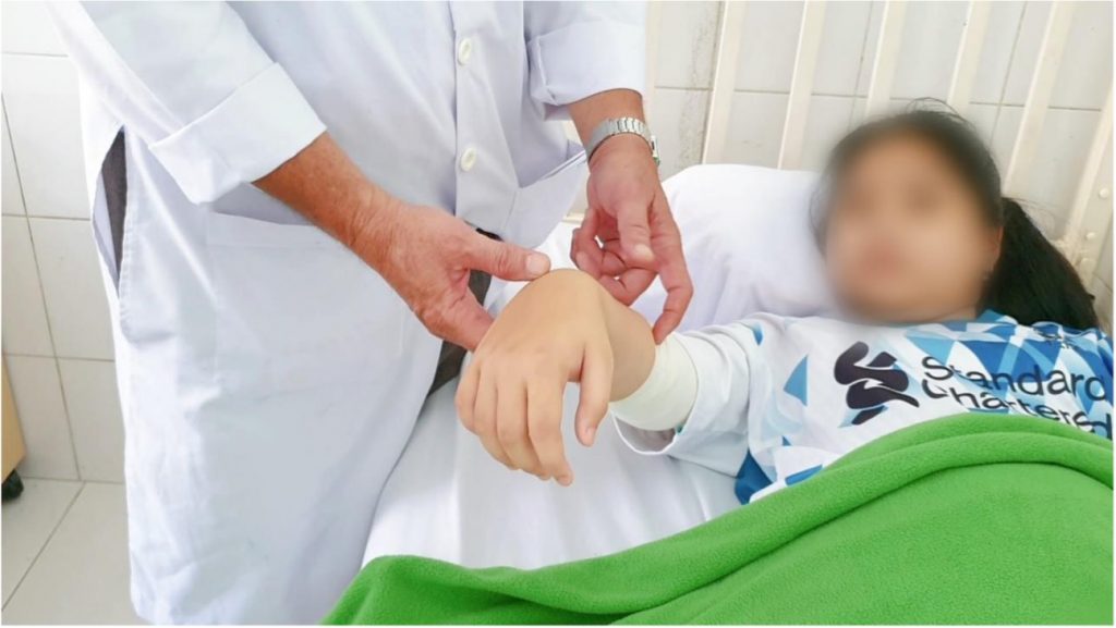 ĐIỀU TRỊ THÀNH CÔNG BỆNH NHI BỊ LIỆT DÂY THẦN KINH QUAY DO KHỐI U VÙNG KHUỶU TAY CHÈN ÉP