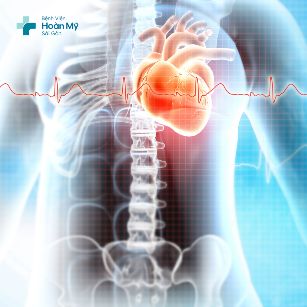 Rối loạn nhịp tim có nguy hiểm không?