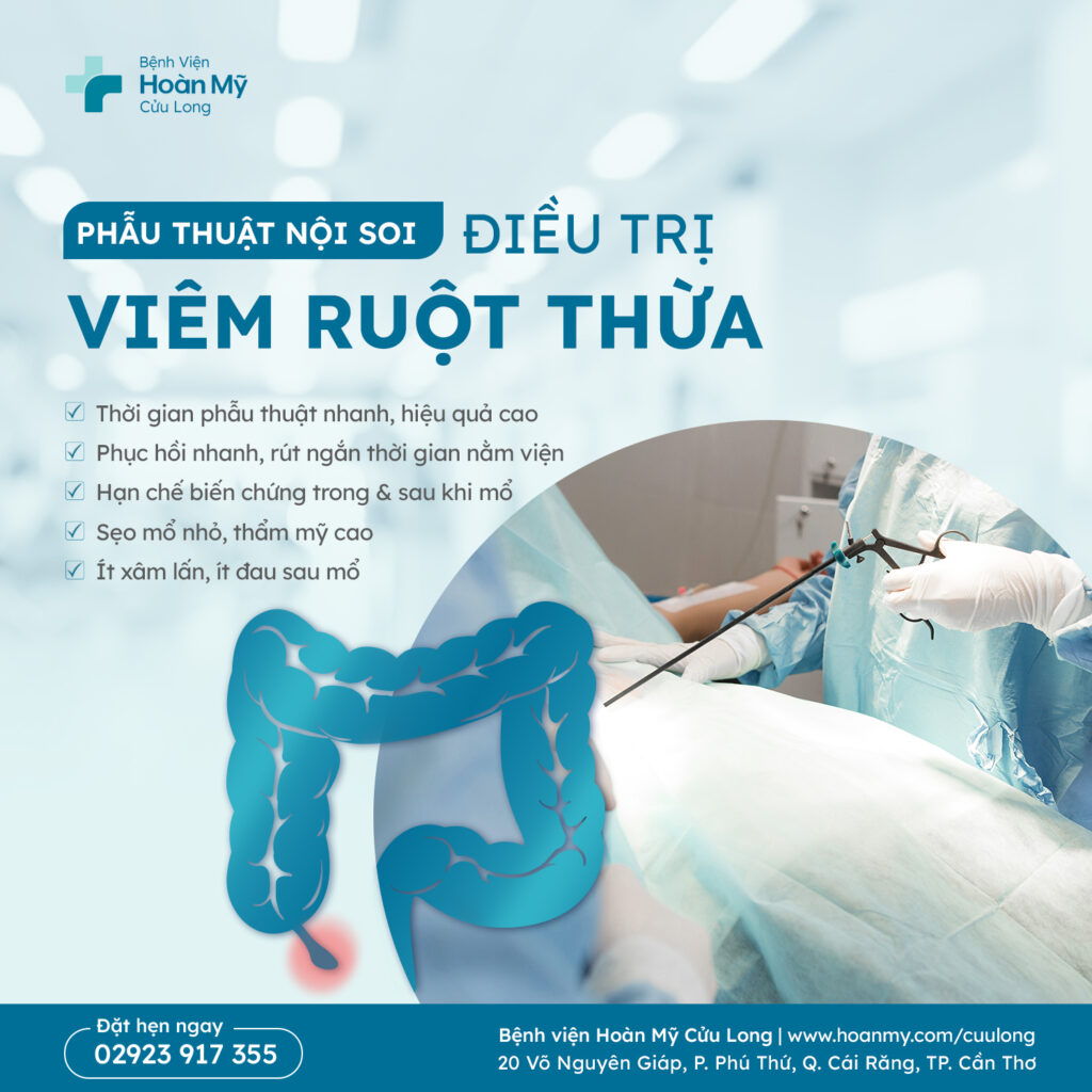 Phẫu thuật nội soi – Giải pháp hiệu quả trong điều trị viêm ruột thừa