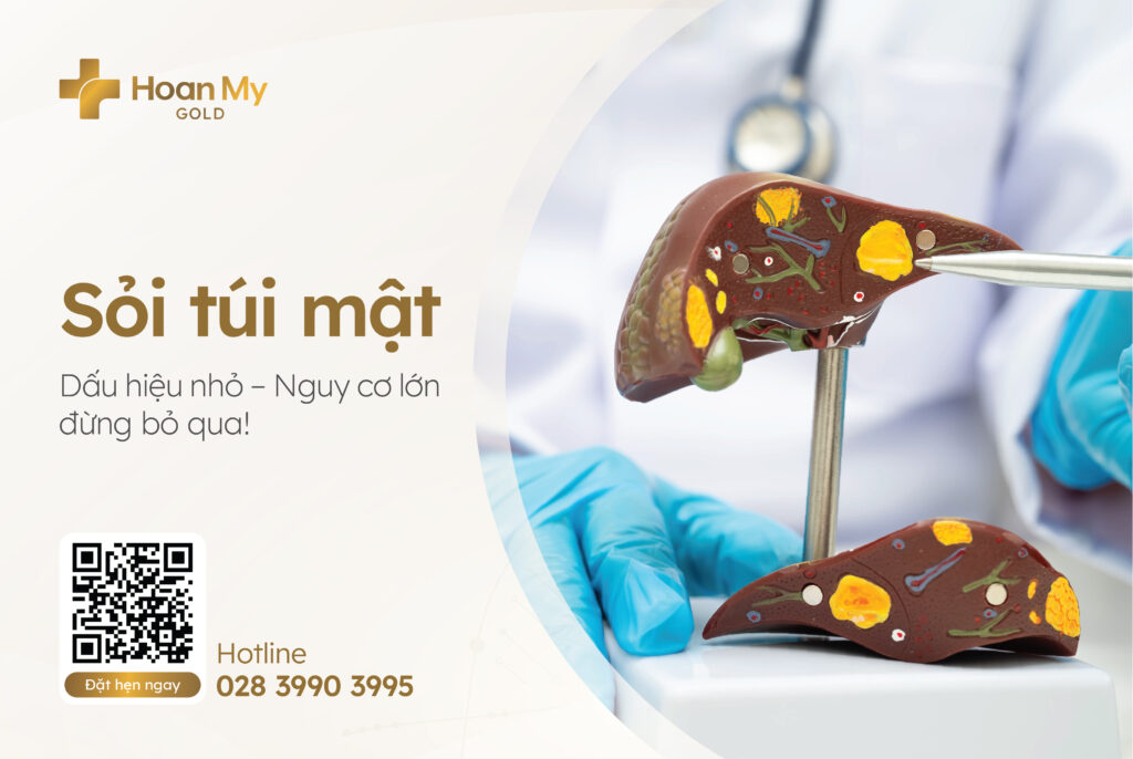 Những điều cần biết về bệnh sỏi túi mật