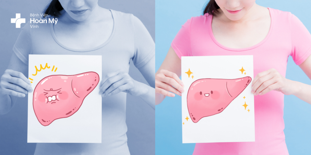 Bệnh gan nhiễm mỡ không do rượu