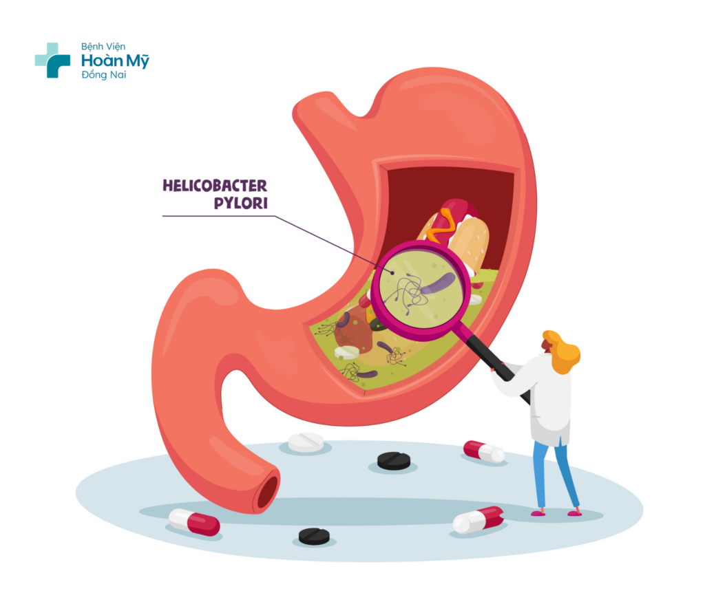 Viêm xung huyết hang vị dạ dày: Vấn đề tiêu hoá thường gặp