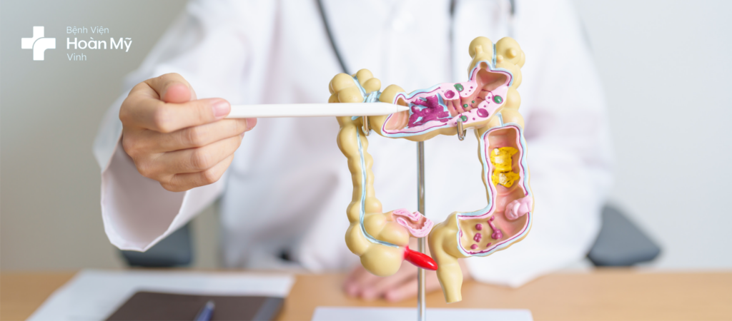 Viêm loét đại trực tràng chảy máu