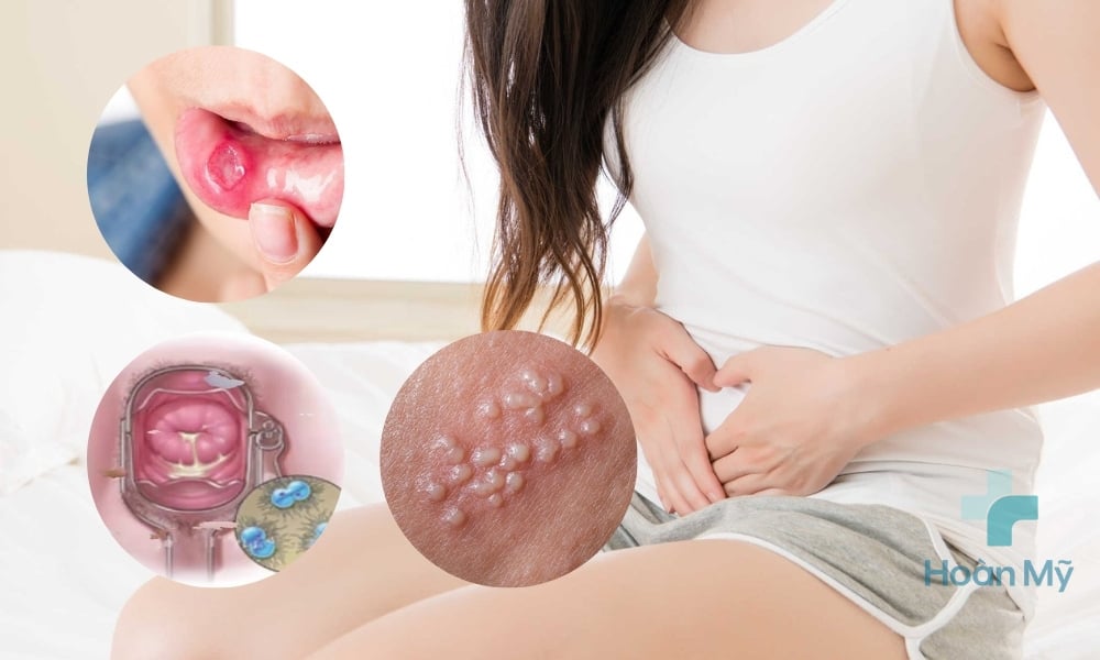 Dấu hiệu, hình ảnh bệnh lậu ở nữ 