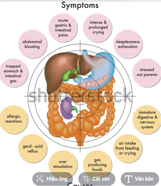Tắc ruột non và già đều có những triệu chứng khác nhau