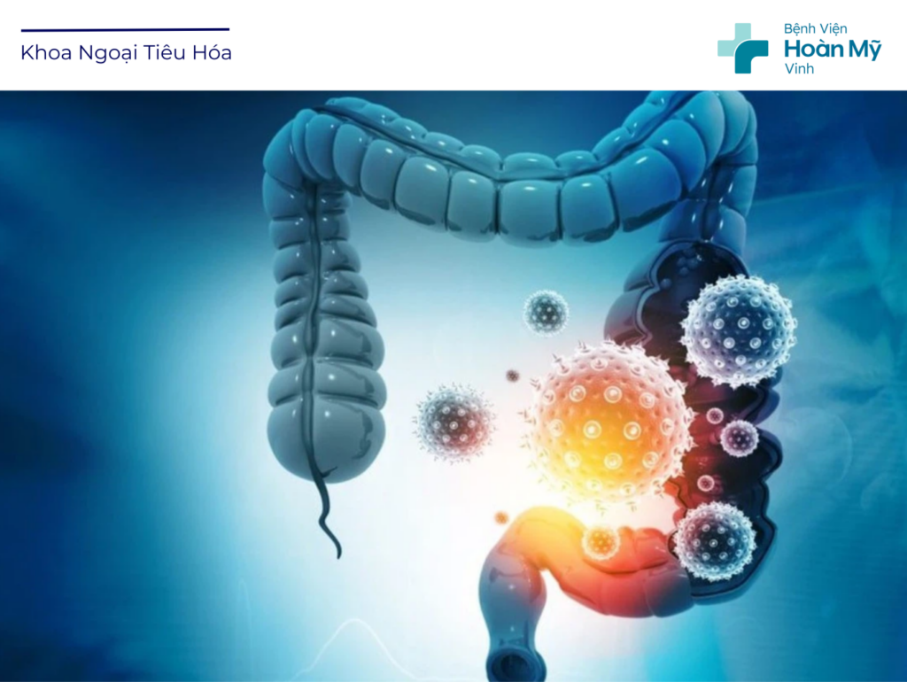 Ung thư đại trực tràng: Nguyên nhân, triệu chứng và các phương pháp chẩn đoán