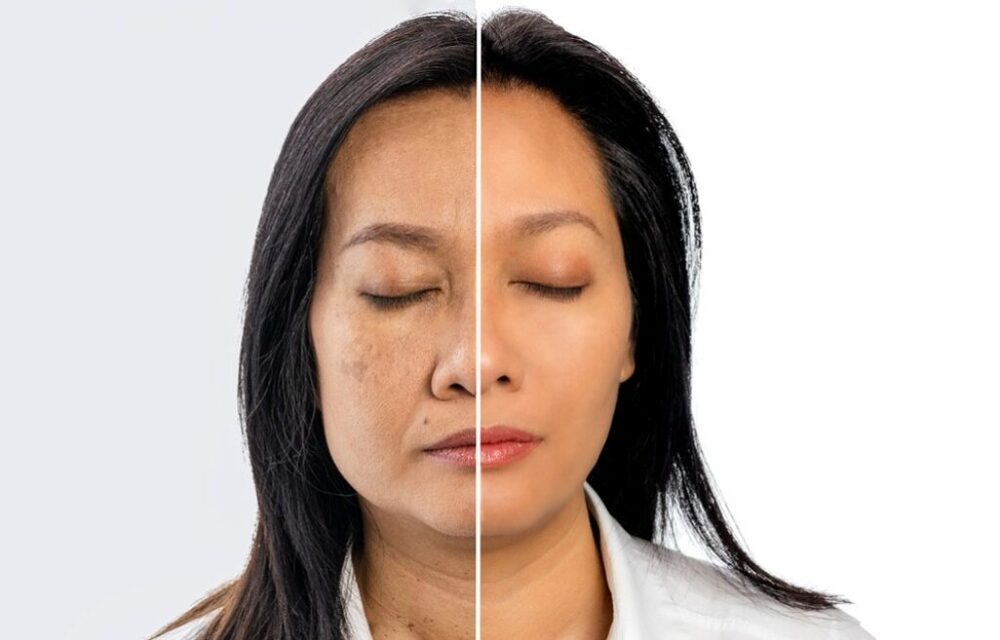 Retinol giúp làm chậm quá trình lão hoá da