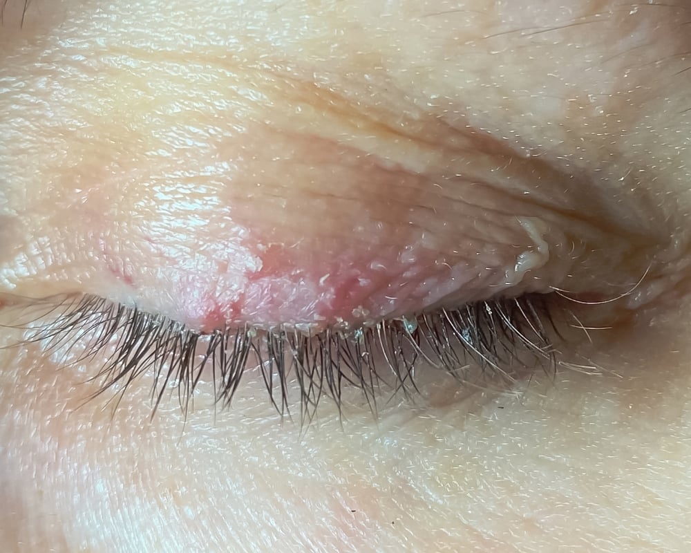 Nhiễm ký sinh trùng: Nguyên nhân, dấu hiệu, chẩn đoán, cách điều trị và phòng bệnh