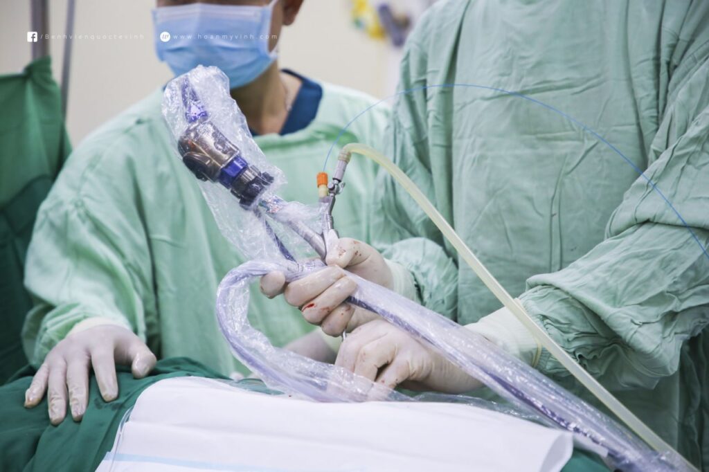 Tán sỏi thận qua da: Phương pháp điều trị hiệu quả, ít xâm lấn