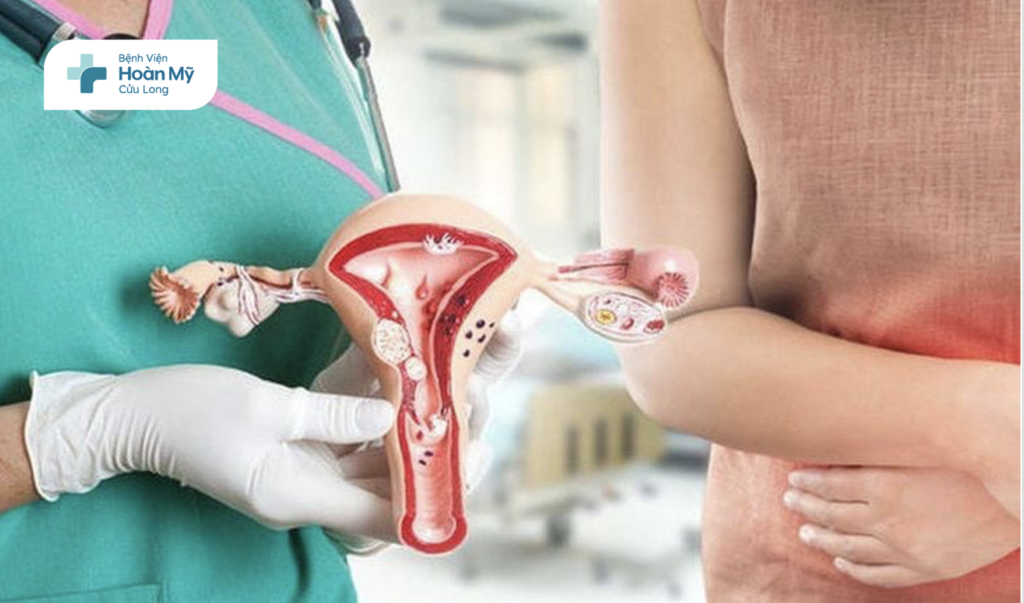 Poly lòng tử cung: Hiểu đúng để điều trị hiệu quả