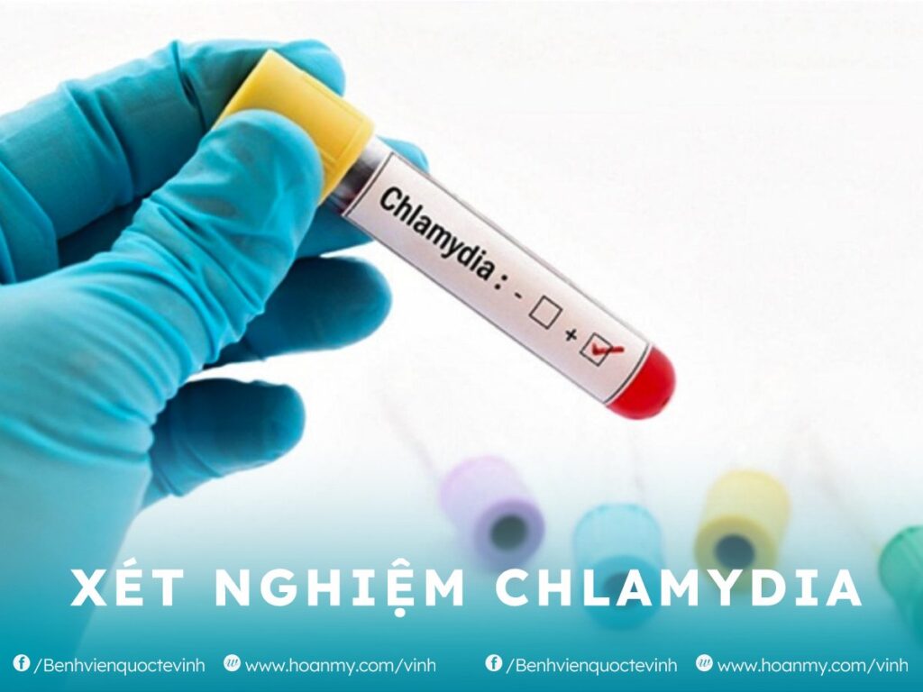 Xét nghiệm Chlamydia